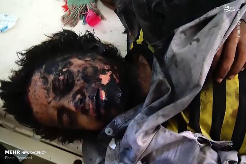 عکس/ حمله وحشیانه جنگنده سعودی به دانشآموزان یمنی عکس/ حمله وحشیانه جنگنده سعودی به دانشآموزان یمنی